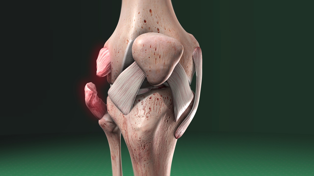 ligamentos colaterales rodilla
